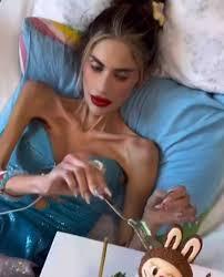 Анорексия докарва риалити звезда до 22 кг и я убива