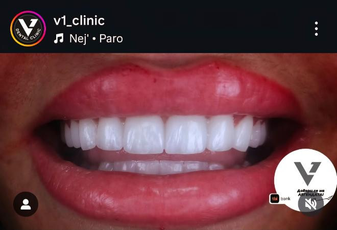 Ванко 1 превърна V1 Clinic във феномен! Няма време дори за море