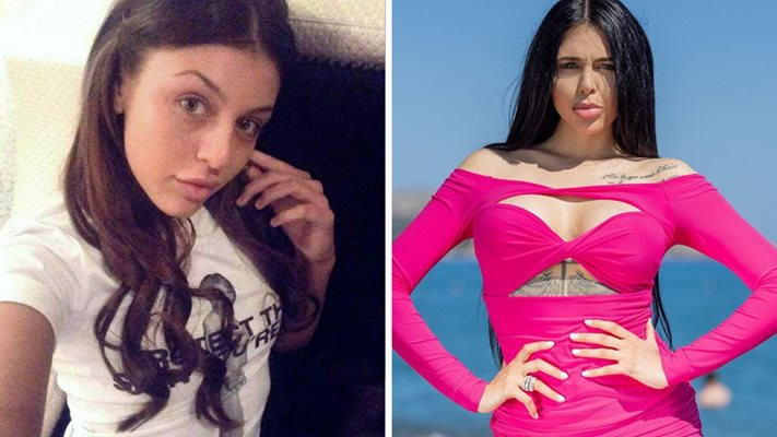 Направила се е на маймуна: Няма да повярвате каква сладурана е била шашавата Емили преди корекциите! (СНИМКИ)