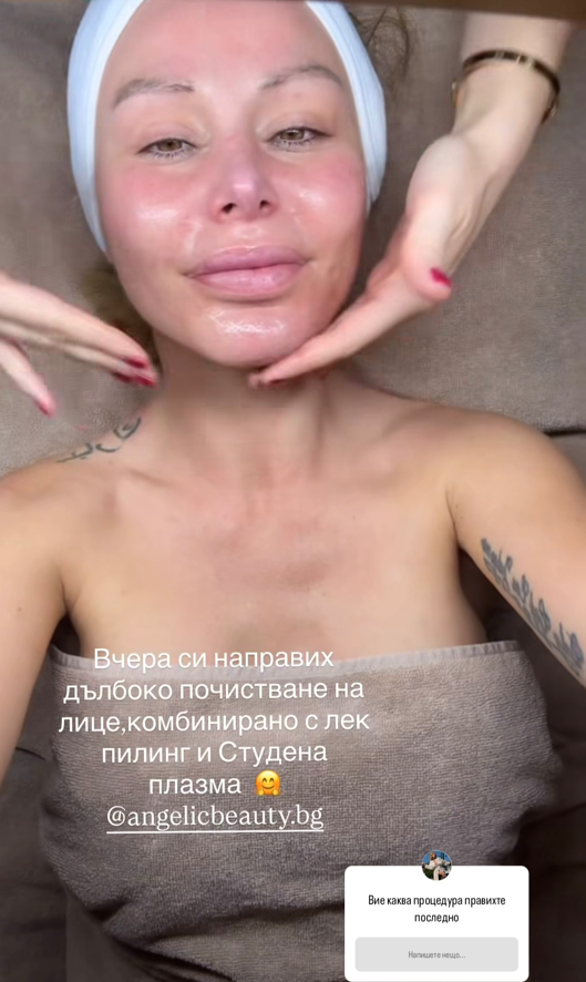Какво ти сториха бе, жено?! Лицето на Светлана Василева изплаши потребителите! (СНИМКИ)